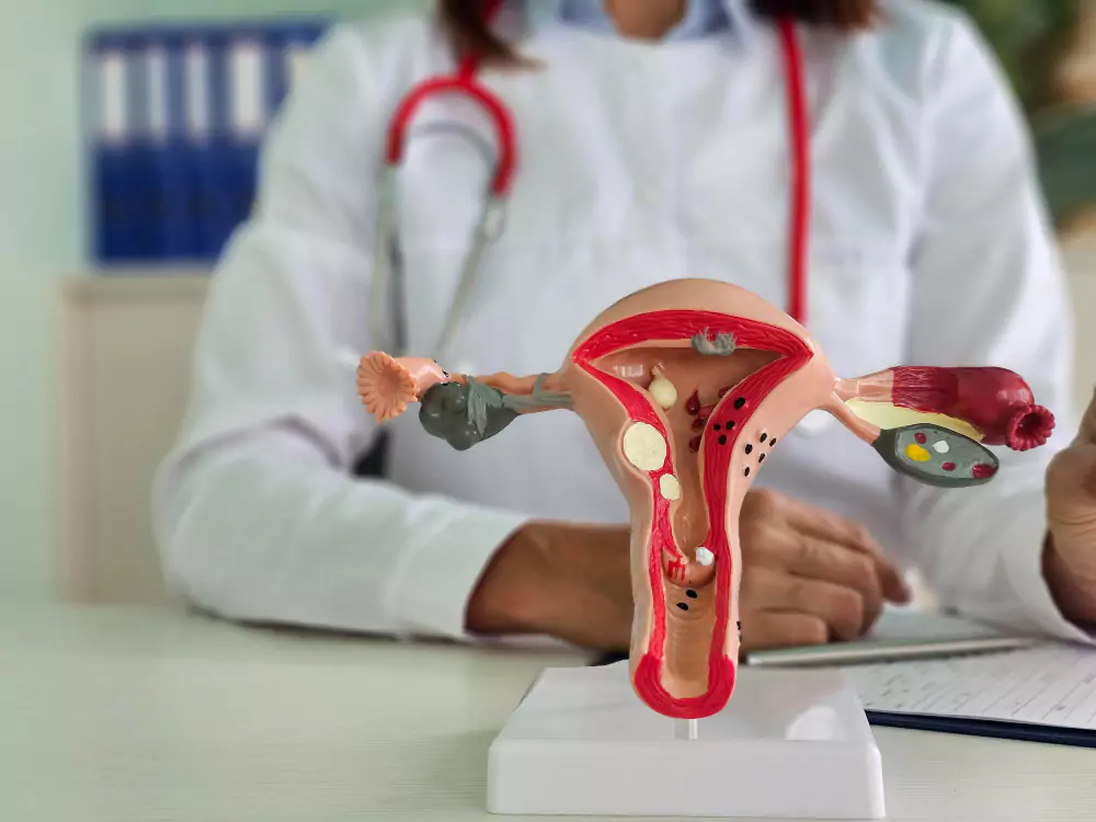 Gynaecology